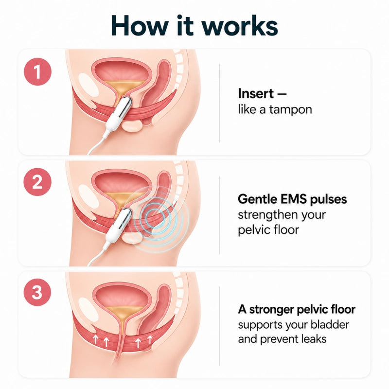 Vivama Pro+ Incontinence Device