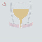 Vivama Pro+ Incontinence Device