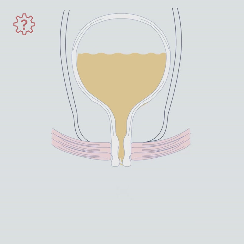 Vivama Pro+ Incontinence Device